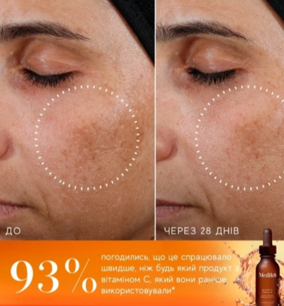 Medik8 SUPER C FERULIC&trade; 7484 фото